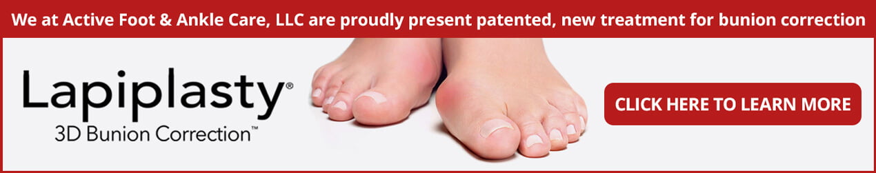 Lapiplasty® 3D Bunion Correction in the Bergen County, NJ: Fair Lawn (Ridgewood, Glen Rock, Woodcliff Lake, Hillsdale, Westwood, Closter, Wyckoff, Ramsey, Oakland) and Englewood (Hackensack, Paramus, Tenafly, Closter, Northvale, East Rutherford); Morris County, NJ: Riverdale (Butler, Kinnelon, Montville, Boonton, Pequannock Township, Lincoln Park) as well as Passaic County, NJ (Hawthorne, Paterson, Clifton, Totowa, Pompton Lakes, Wanaque, Wayne, Macopin, Ringwood) and Hudson County, NJ (Secaucus, North Bergen) areas